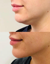 Cargar imagen en el visor de la galería, Masajador cuello y papada con vibración
